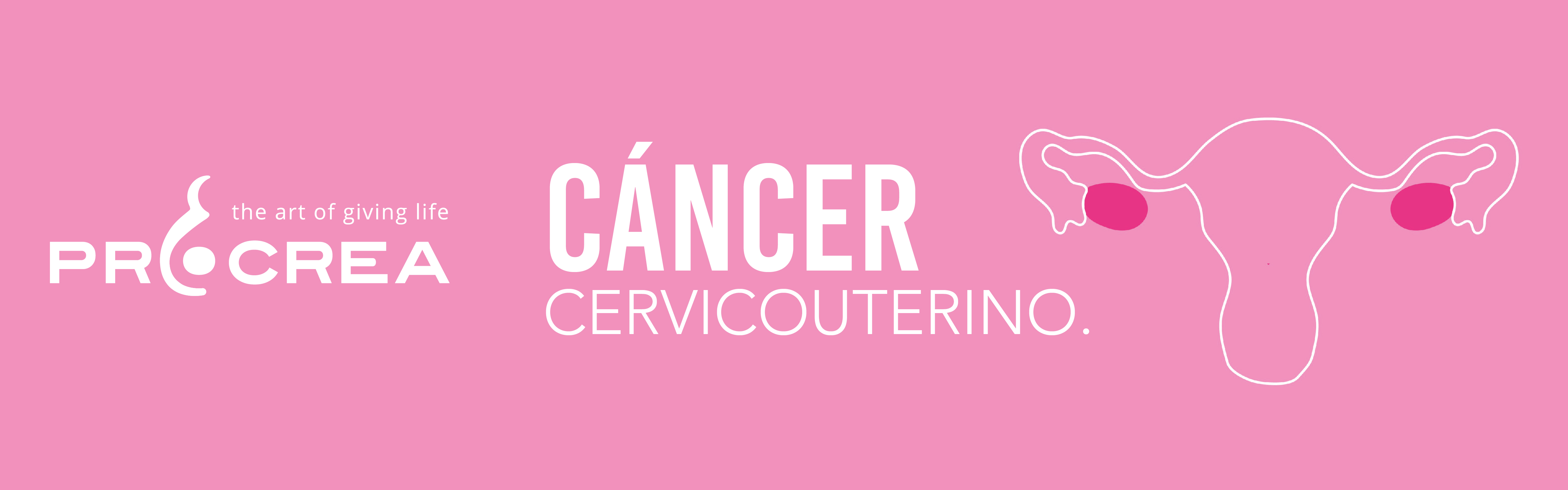 Cáncer cervicouterino un enemigo silencioso
