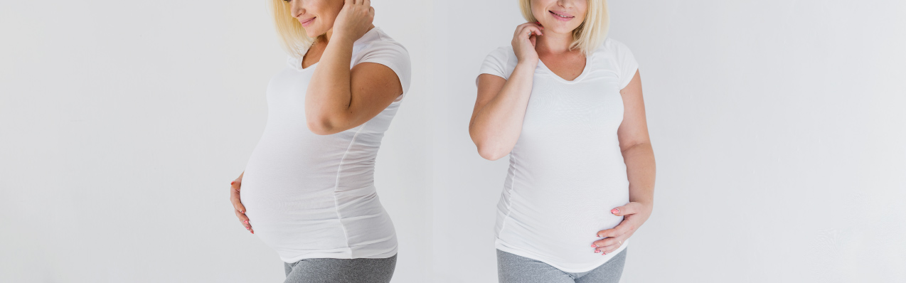 La obesidad afecta principalmente a las mujeres en edad fértil