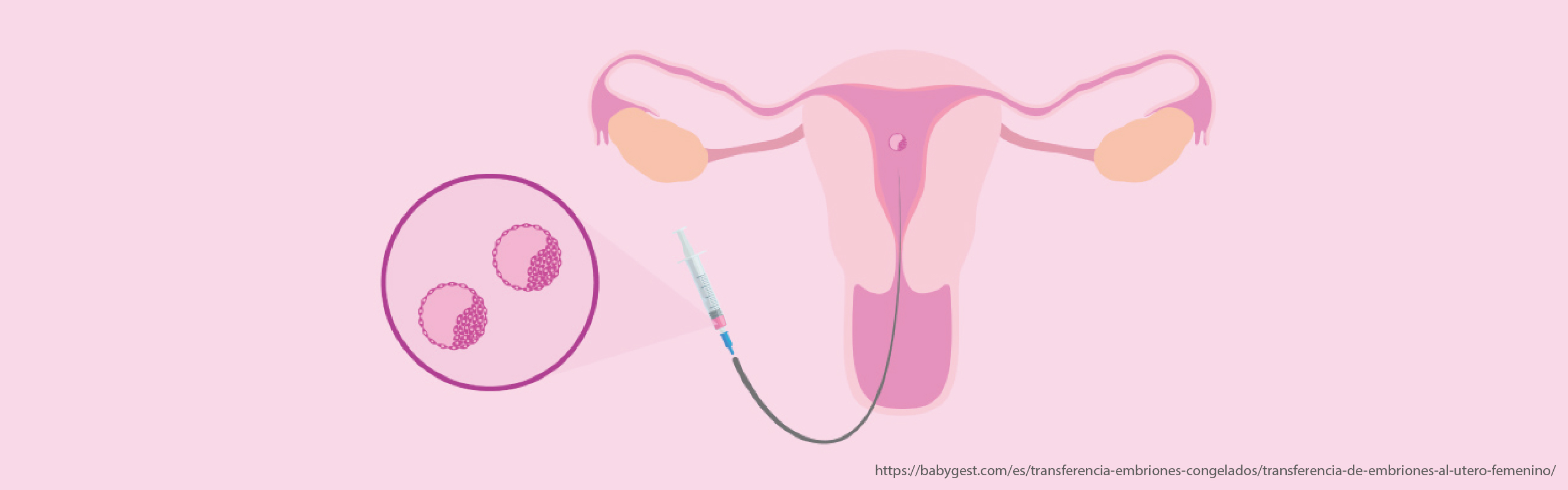 La transferencia embrionaria es más sencilla de lo que pensabas