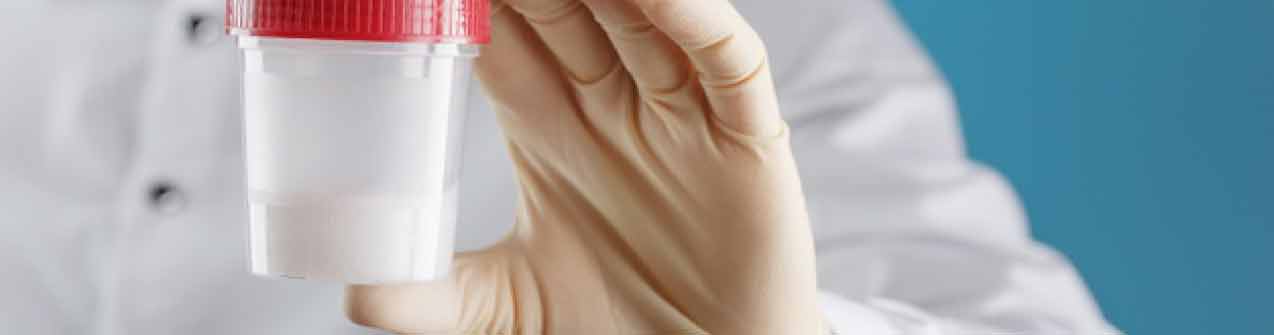 Inseminación artificial con semen donante