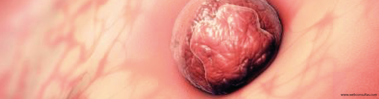 La ventana de implantación en el FIV