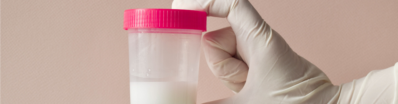 Lavado de seminal para inseminación intrauterina